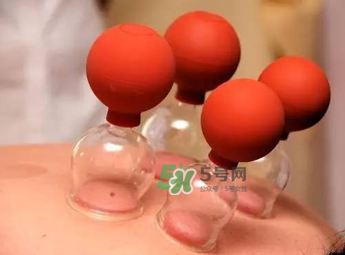 三伏天拔罐好嗎？三伏天拔罐好還是艾灸好？