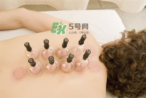 三伏天拔罐好嗎？三伏天拔罐好還是艾灸好？