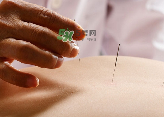 陰天下雨能針灸嗎？陰天下雨可以針灸嗎