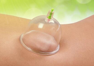 三伏天拔罐后多久可以洗澡？三伏天拔罐后注意事項(xiàng)