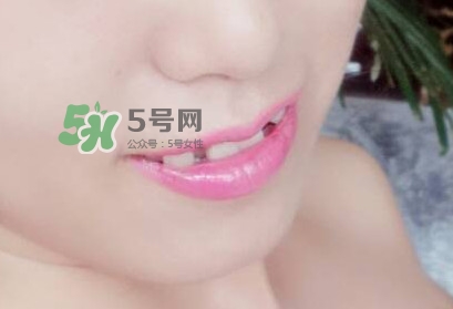 牙齒縫隙大怎么辦？牙縫大帶牙套有用嗎