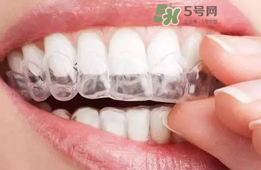 牙齒有縫隙可以補嗎？牙齒縫隙大能補嗎