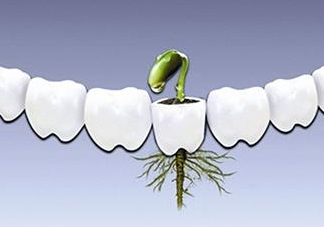 種植牙多少錢(qián)一顆？為什么種植牙很貴