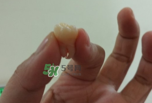 拔智齒痛嗎？智齒拔了多久洞會好？