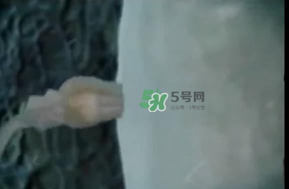 懷孕初期怎么保胎？陰道出血是流產(chǎn)征兆嗎？