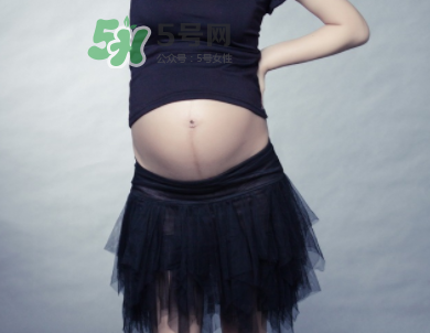 頭胎有妊娠線二胎沒有是因為寶寶性別不一樣嗎？