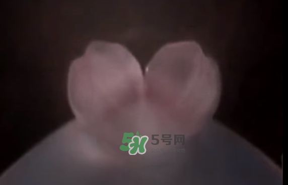 懷孕初期怎么保胎？陰道出血是流產(chǎn)征兆嗎？