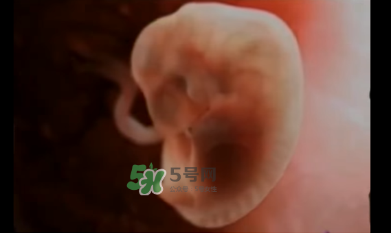 懷孕初期怎么保胎？陰道出血是流產(chǎn)征兆嗎？