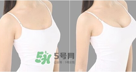 女性乳頭癢是怎么回事？女性乳頭癢要怎么治療？