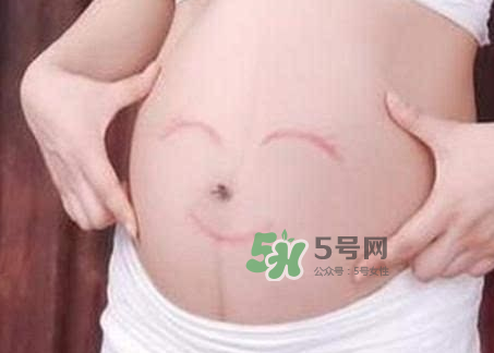 產婦胃脹氣怎么緩解？產婦胃脹氣怎么辦？