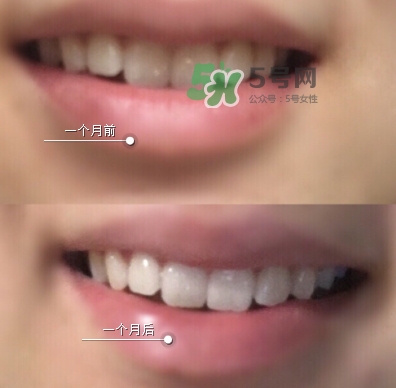 regenerate牙膏白色蓋和金色蓋區(qū)別_哪個好 regenerate牙膏白色蓋和金色蓋區(qū)別_哪個好