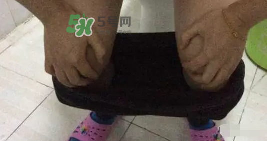 孕期可以蹲著上廁所嗎？孕期上廁所會壓到寶寶嗎？