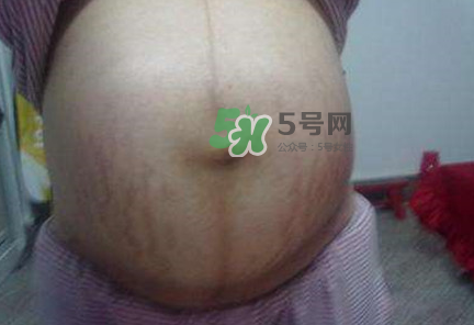 懷女孩肚子上會長毛嗎？懷女孩肚子特征圖片