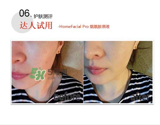 homefacialpro煙酰胺原液怎么樣？hfp煙酰胺原液好用嗎