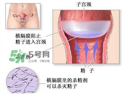 殺精劑避孕可靠嗎？殺精劑避孕要注意什么？