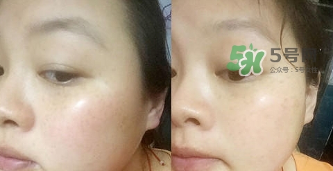 可思美潔面儀好不好用？可思美凈致潔顏聲波潔面儀怎么樣？