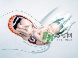 順產(chǎn)和剖腹產(chǎn)哪個(gè)好？順產(chǎn)和剖腹產(chǎn)哪個(gè)痛？