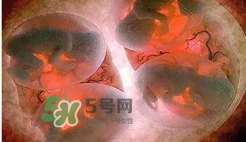 多胞胎順產(chǎn)怎么生？多胞胎剖腹產(chǎn)和單胎剖腹產(chǎn)的區(qū)別