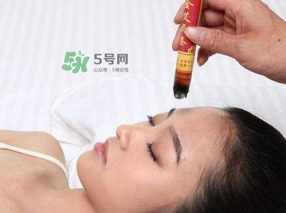 艾灸會不會過敏？艾灸過敏怎么辦