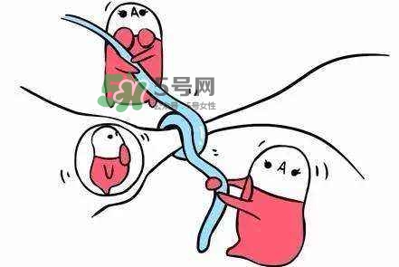 結(jié)扎好還是上環(huán)好？結(jié)扎上環(huán)哪個(gè)危害小？