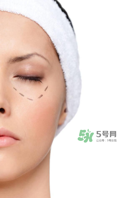 近視手術(shù)多少度不能做？多少度可以做近視手術(shù)？