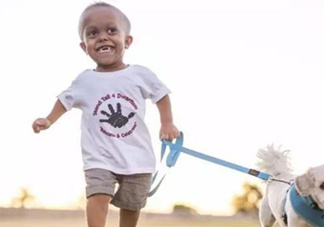 侏儒癥遺傳嗎？侏儒癥在嬰幼兒期有何表現(xiàn)？