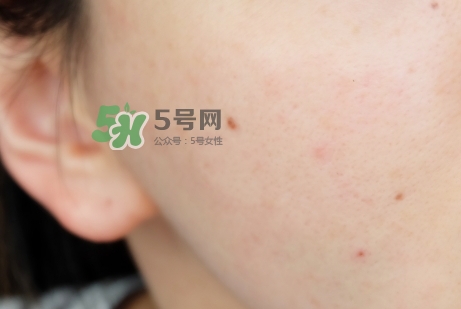 臘梅是什么牌子？臘梅是什么護(hù)膚品