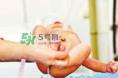 羊水栓塞是醫(yī)療事故嗎？羊水栓塞多發(fā)生于順產(chǎn)還是剖腹產(chǎn)？