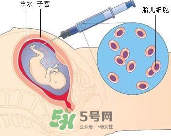 羊水栓塞是怎么回事？羊水栓塞怎么預(yù)防？