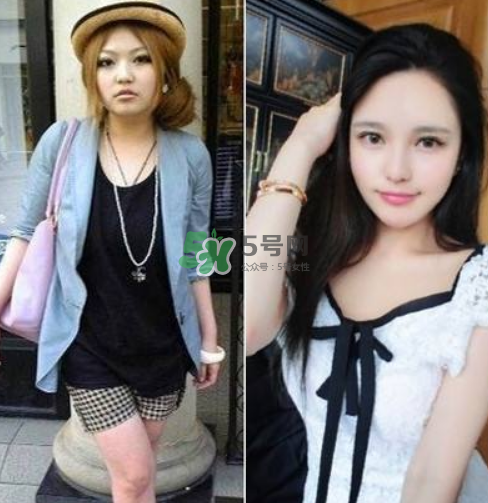 周揚(yáng)青在哪里整容的？周揚(yáng)青整容整了哪里？