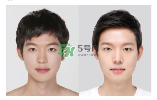 美白針有副作用嗎？美白針有什么副作用？