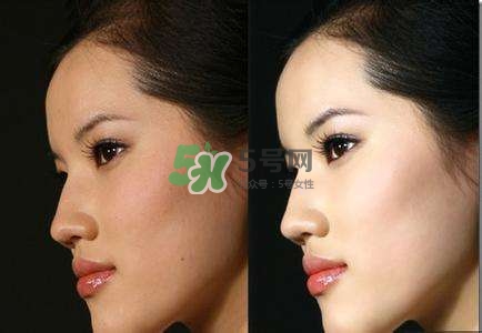 美白針有副作用嗎？美白針有什么副作用？