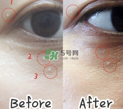 tsubu night pack真假 tsubu night pack脂肪粒眼霜效果 tsubu night pack真假 tsubu night pack脂肪粒眼霜效果