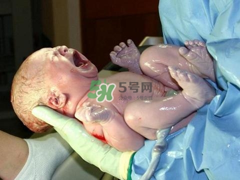 順產(chǎn)有多疼？順產(chǎn)的疼痛可以忍受嗎？