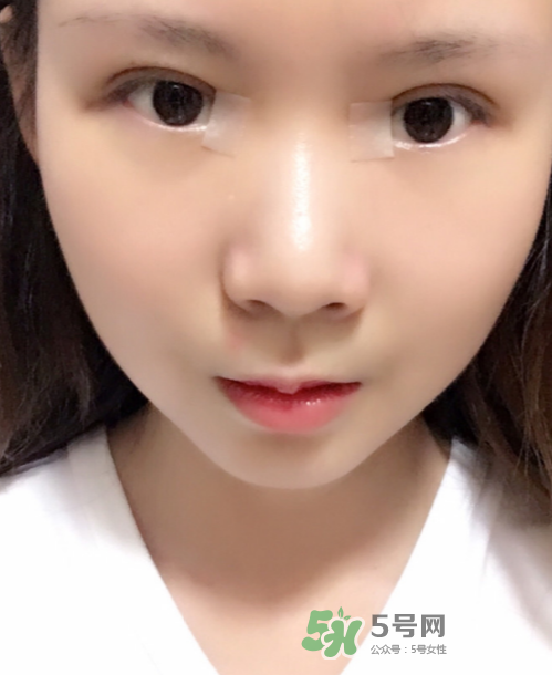 美皮護(hù)去疤效果怎么樣？美皮護(hù)有用嗎？