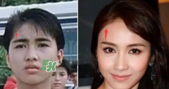 發(fā)際線低怎么調(diào)整？標(biāo)準(zhǔn)的發(fā)際線圖片