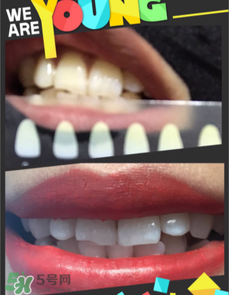 碧緹福美牙儀有副作用嗎？碧緹福美牙儀副作用是什么？