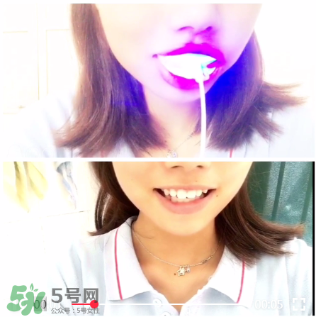 美牙儀能治氟斑牙嗎？氟斑牙可以用美白儀嗎？