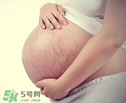 孕婦胸部長妊娠紋嗎？胸部長妊娠紋了怎么辦？