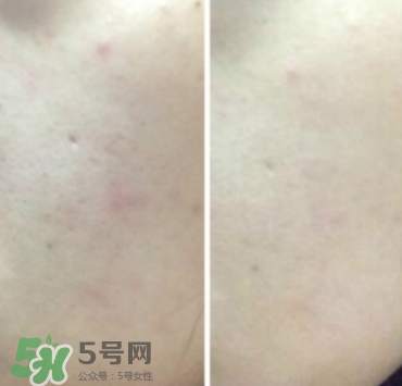 美康粉黛氣墊bb怎么樣？美康粉黛氣墊bb毀容