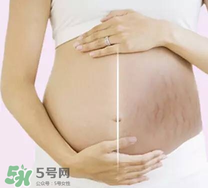 長妊娠紋的前兆 長妊娠紋很癢怎么辦？