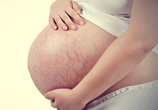 孕婦胸部長(zhǎng)妊娠紋嗎？胸部長(zhǎng)妊娠紋了怎么辦？