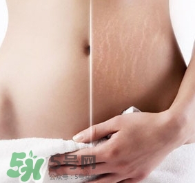 妊娠紋什么時(shí)候變白？妊娠紋產(chǎn)品什么時(shí)候用？