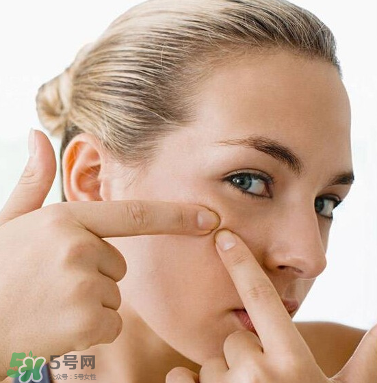 長痘長閉口怎么辦？長痘長閉口是什么原因？