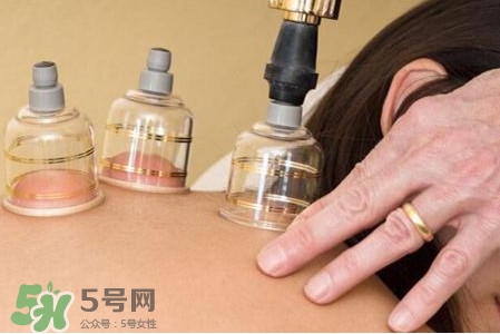 真空拔罐有用嗎？真空拔罐多長(zhǎng)時(shí)間合適