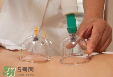 真空拔罐有用嗎？真空拔罐多長(zhǎng)時(shí)間合適