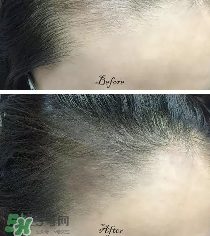 發(fā)際線粉要卸妝嗎_怎么卸？