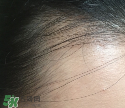 發(fā)際線粉要卸妝嗎_怎么卸？