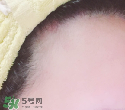 發(fā)際線粉哪個牌子好？