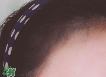 發(fā)際線粉哪個牌子好？